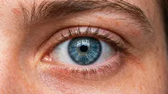 Jak zvednout povislé víčko? 3 hlavní příčiny a metody korekce