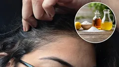 Jaké jsou výhody použití octa a jedlé sody k odstranění šedivých vlasů a jak to správně dělat?